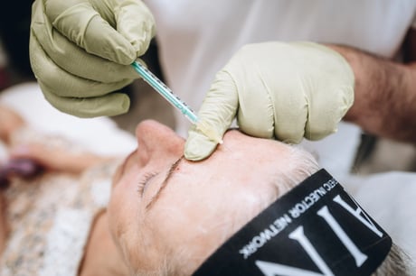 Stirnfalte Botox MY HEALTH AND BEAUTY