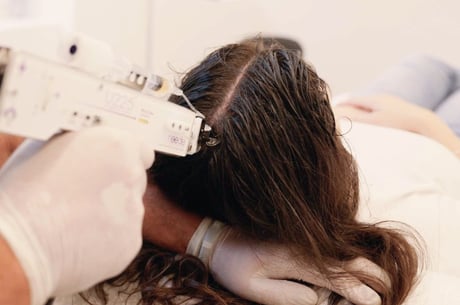 PRP Haartherapie MY 8