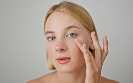 Augenringe unterspritzen MY 1