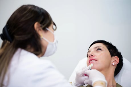 Lippen aufspritzen MY HEALTH AND BEAUTY