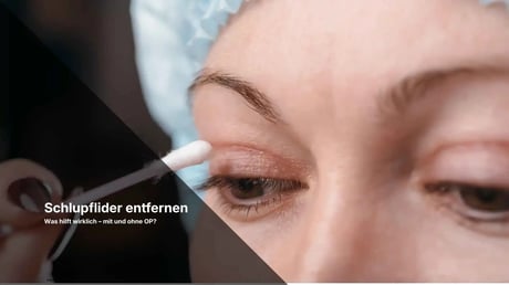 Close-up of eye with cotton swab during eyelid procedure, text 'Schlupflider entfernen'.