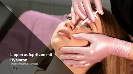 Lippen aufspritzen mit Hyaluron: Was du wirklich wissen musst