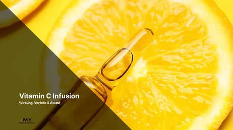 Vitamin C Infusion: Wirkung, Vorteile & Ablauf 