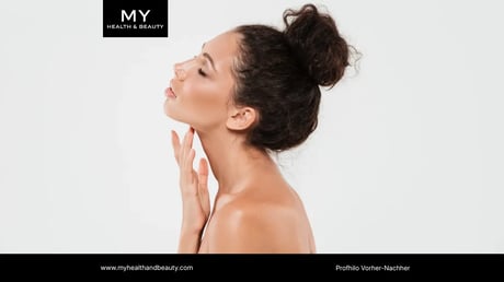 Profhilo Vorher-Nachher: Welche Ergebnisse sind realistisch?- MY HEALTH AND BEAUTY