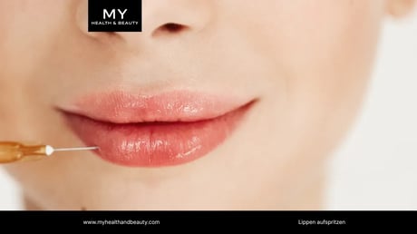 Close-up of a person receiving a lip filler injection for fuller, glossy lips.