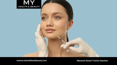 Masseter Botox Vorher Nachher kosten