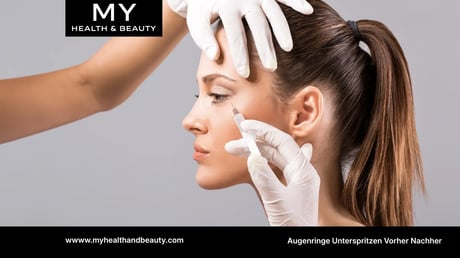 Augenringe Unterspritzen Bilder MY HEALTH AND BEAUTY 