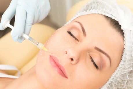 profhilo  my health and beauty kosten