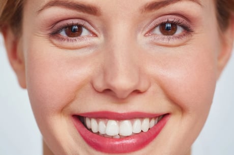 Krähenfüße botox my health and beauty