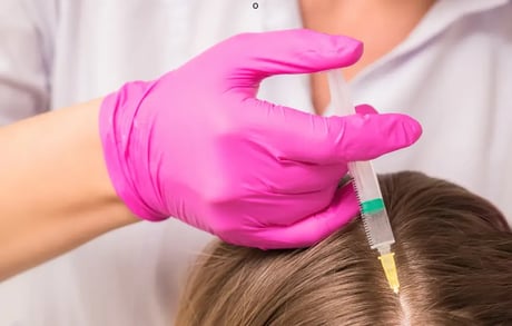 Mesotherapie Haare MY HEALTH AND BEAUTY