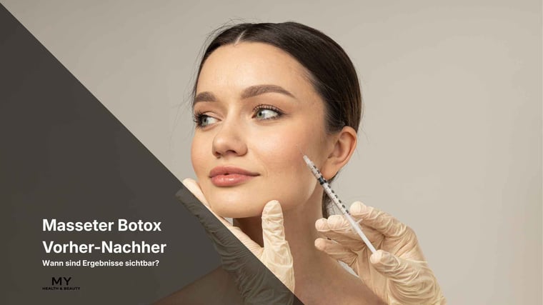 Eine Masseter Botox®-Behandlung vorher nachher