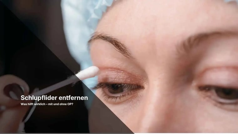 Close-up of eye with cotton swab during eyelid procedure, text 'Schlupflider entfernen'.