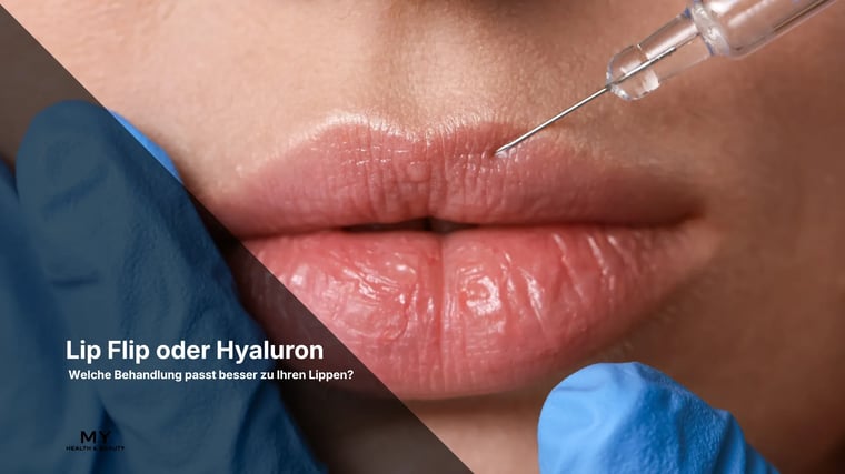 Lip Flip oder Hyaluron - MY HEALTH AND BEAUTY