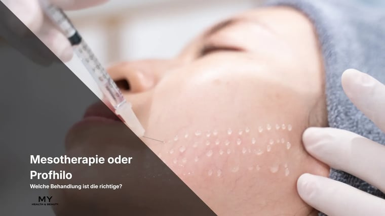 Mesotherapie oder Profhilo – Welche Behandlung ist die richtige?