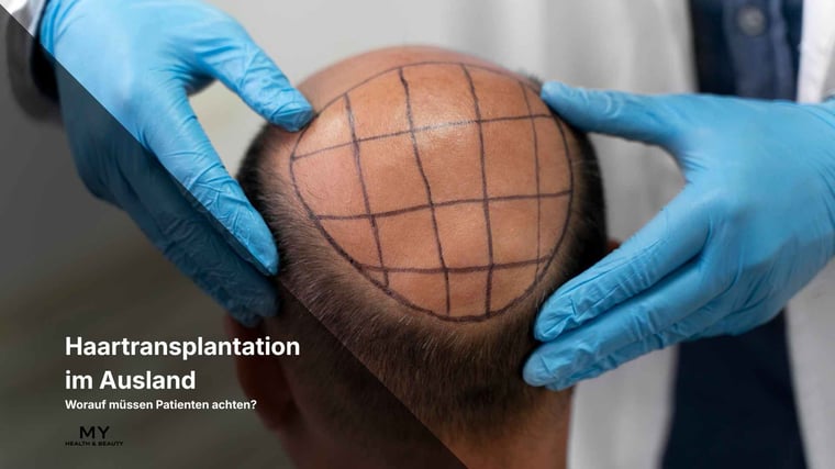 Haartransplantation im Ausland: Worauf müssen Patienten achten?