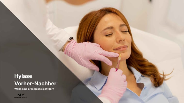 Hylase Vorher Nachher – Wann sind Ergebnisse sichtbar?