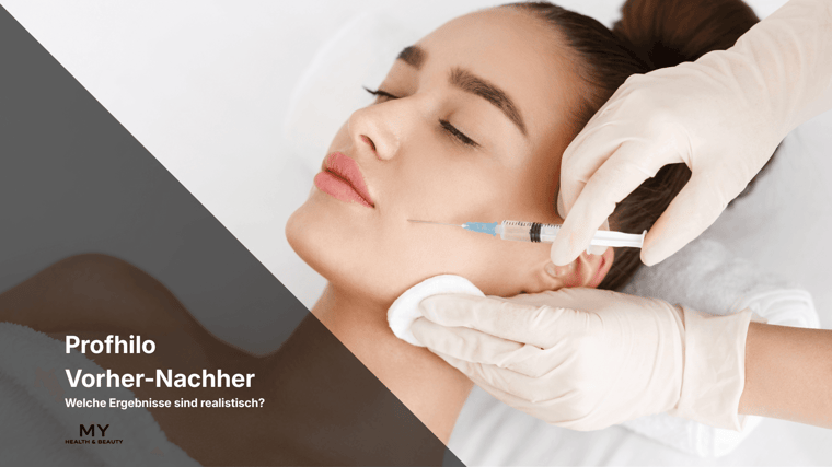 Profhilo Vorher-Nachher: Welche Ergebnisse sind realistisch?